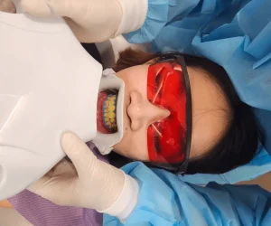 teeth whitening with dr chun