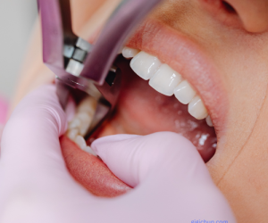 tooth extraction